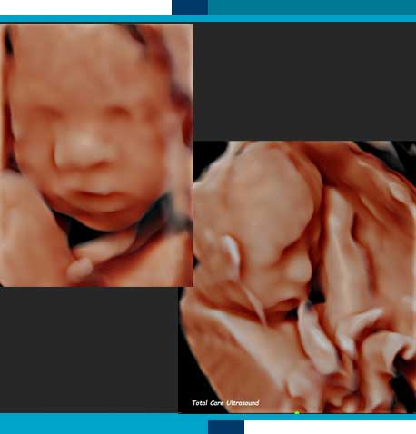 3D / 4D Ultrasounds in Navasota