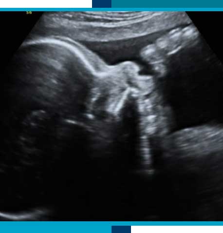 Last Peek Pregnancy Ultrasounds in Navasota