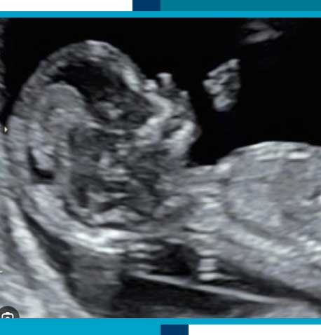 Pregnancy Ultrasounds in Navasota, TX
