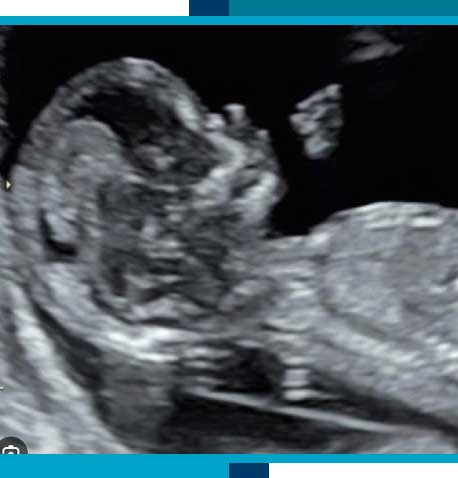 Pregnancy Ultrasounds in Navasota, TX