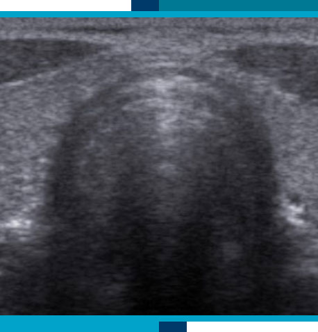 Scrotal and Thyroid Ultrasounds in Navasota and Tomball, TX