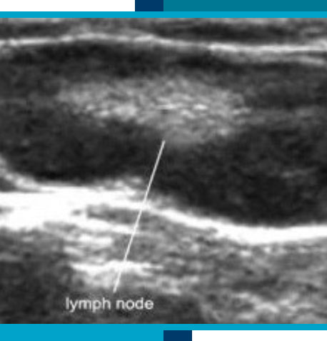 Superficial / Soft Tissue / Breast Ultrasounds