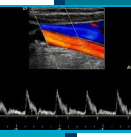 Vascular Ultrasounds